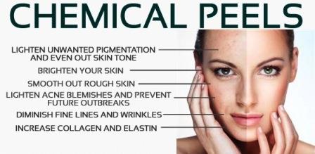 chemical peels